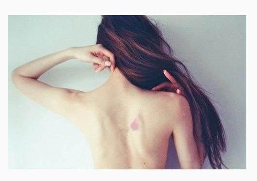 你的胎记痣在哪里就是什么命运, 比算命还准!_