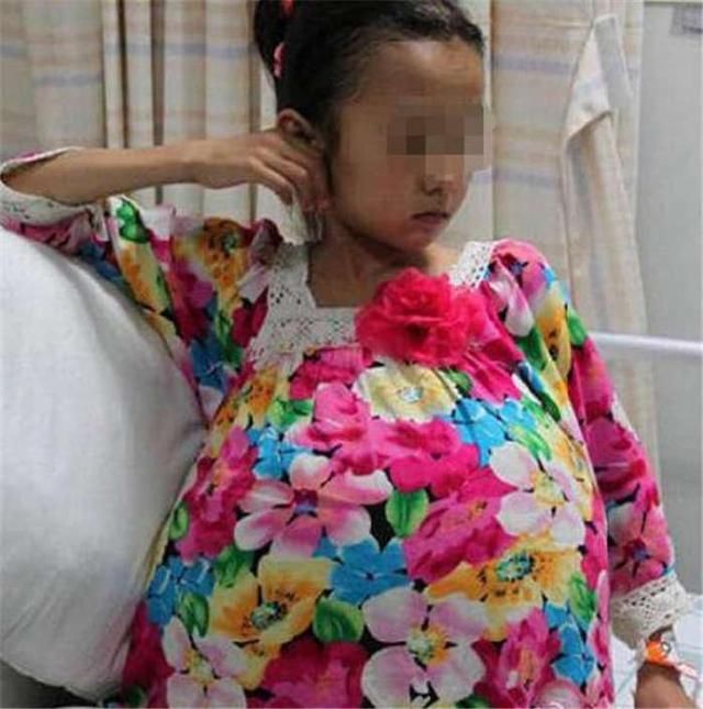 10岁女孩肚大如球,像怀孕9个月,医生剖腹产下3斤重"婴儿"