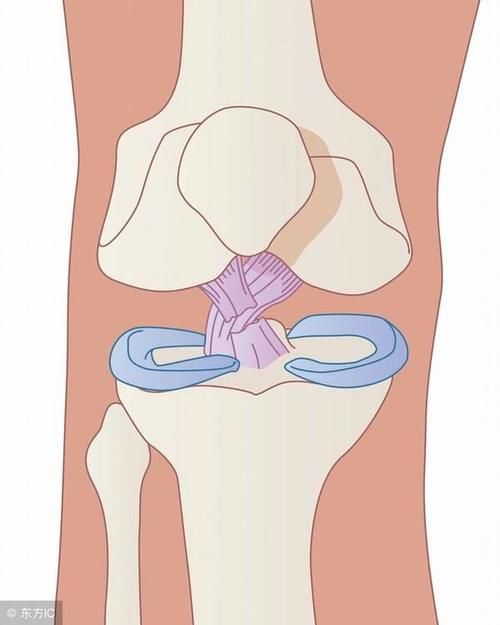 得了膝关节炎如何正确减痛和锻炼呢?这篇真相