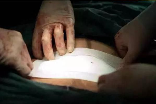 男生肚子照片真实图片 t01cb99565fce6bf62a.jpg