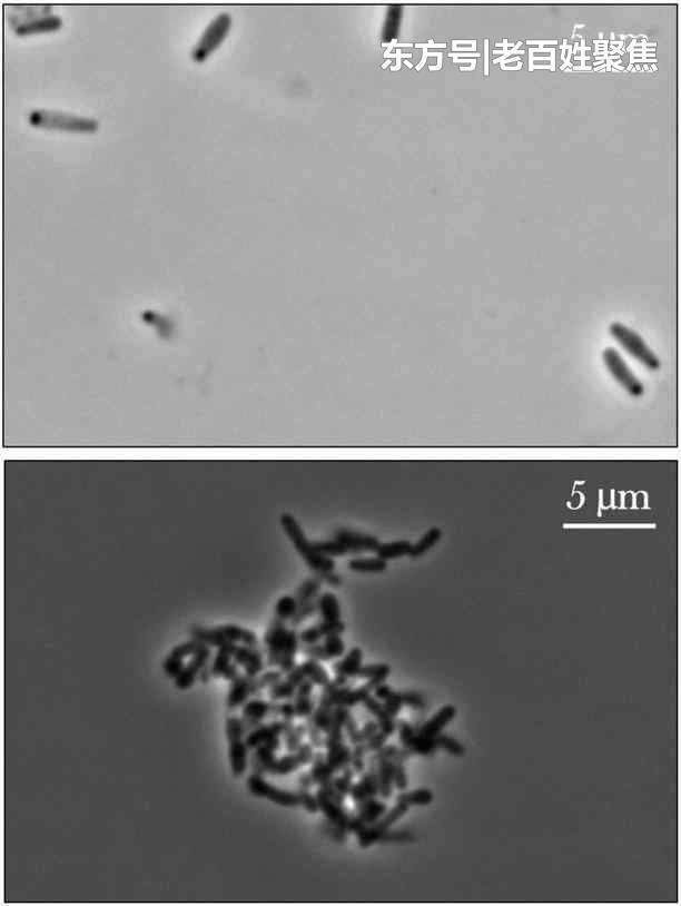 细菌到了太空变得更强大! 一般剂量的抗生素杀不死