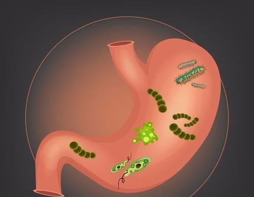 感染幽门螺旋杆菌胃炎