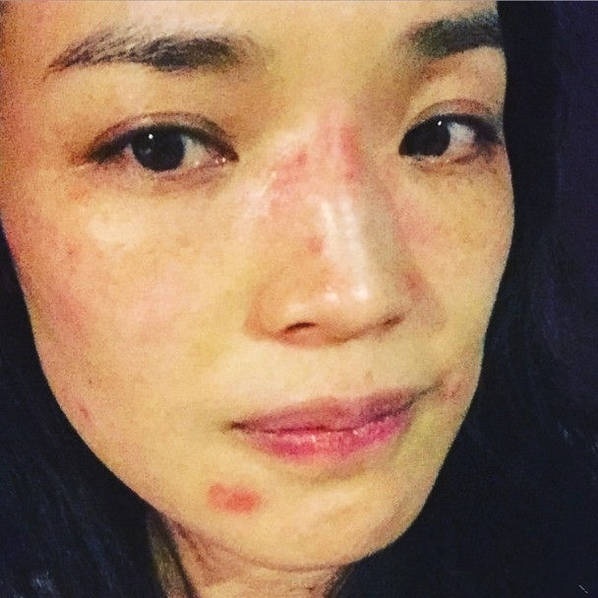 舒淇懒理皮肤过敏为爱猫庆生 揽猫唱歌超Swe