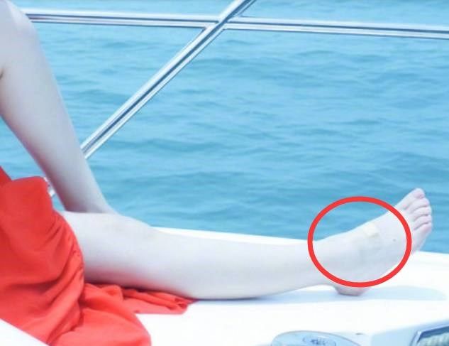 赵丽颖晒游艇美照,被发现两个脚都伤了,网友:怎
