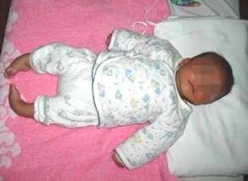 孩子一岁多都不会走路,送去医院检查,结果被指