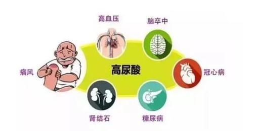 尿酸为什么会高?推荐4个方法降尿酸,让你远离