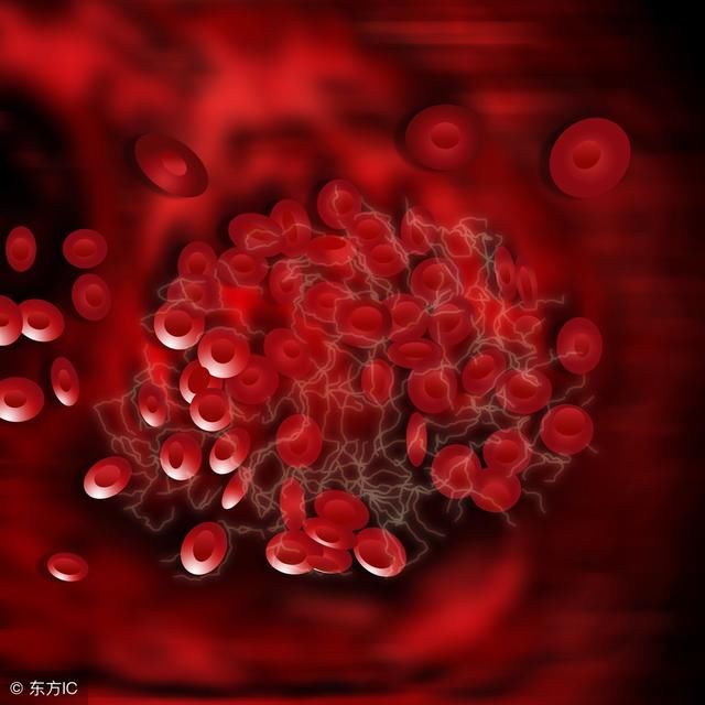 脑血栓到底是如何形成的 这三个原因不得不防