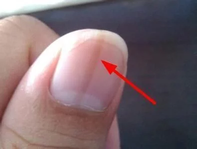 2018年03月08日 - 锦上添花 - 锦上添花博客 2018年03月08日 - 锦上添花 - 锦上添花博客