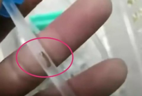 医院致歉幼儿输液管中有虫