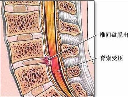 为什么脖子发硬一转就嘎巴响