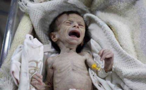 实拍:体重不到4斤的女婴,身体骨瘦如柴,如同一