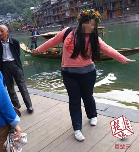 18岁少女贪吃成300多斤大胖妞,缩胃术后一周