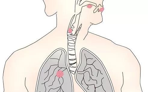 睡觉手机放床头危害身体？你家里的“辐射人”危险80倍！