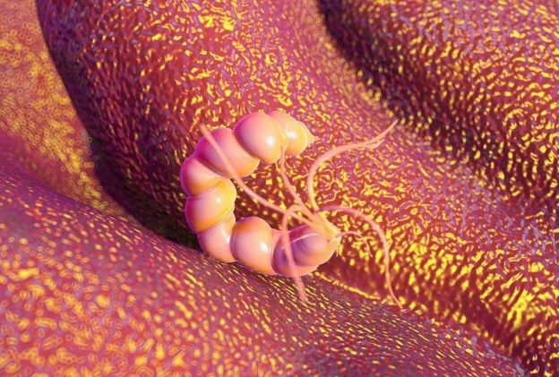 胃壁杀手:幽门螺旋杆菌,是胃溃疡的主要犯罪嫌