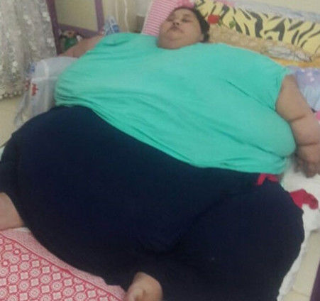 340公斤全球最肥女胖子