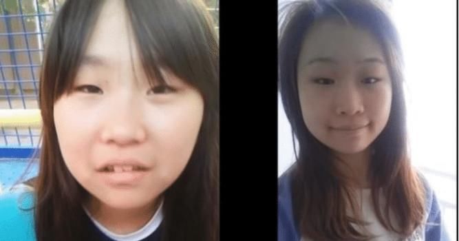 初中生辍学沉迷整容，花费巨资一年整容20次