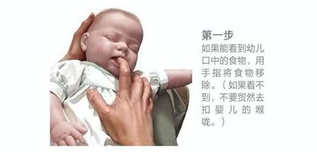 孩子被异物卡喉、三步救命第一步谁都会最管用的二三步你会了吗?