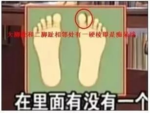 老年痴呆很可怕，预防原来这么简单，可惜99%的人不知道