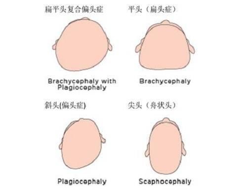 “睡平头”一个时代的审美 一代人的噩梦