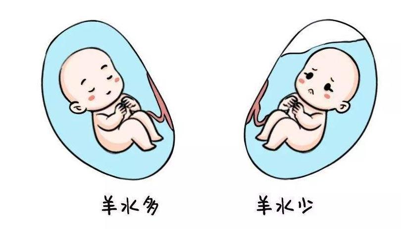 孕期常识:怎么判断胎儿是不是缺氧?3个方面早