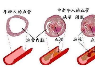 血管老不老低头摸一处，天哪太准了！