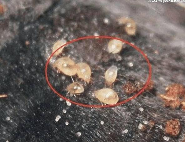 毛孔聚积螨虫, 脸上4个部位会说话, 常用3招快