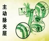 这四种人群注意 别把胸背痛不当回事！