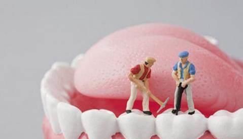 为什么出现牙结石,医生经常建议洗牙?理由在