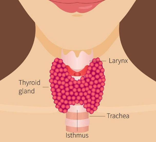 得了甲状腺结节饮食上该注意什么?怎么吃能去