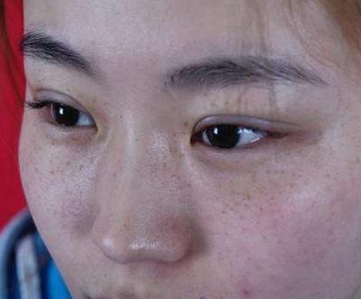 香蕉捣碎加点"它",一夜醒来斑点全消,无意间,皮肤嫩如小宝宝